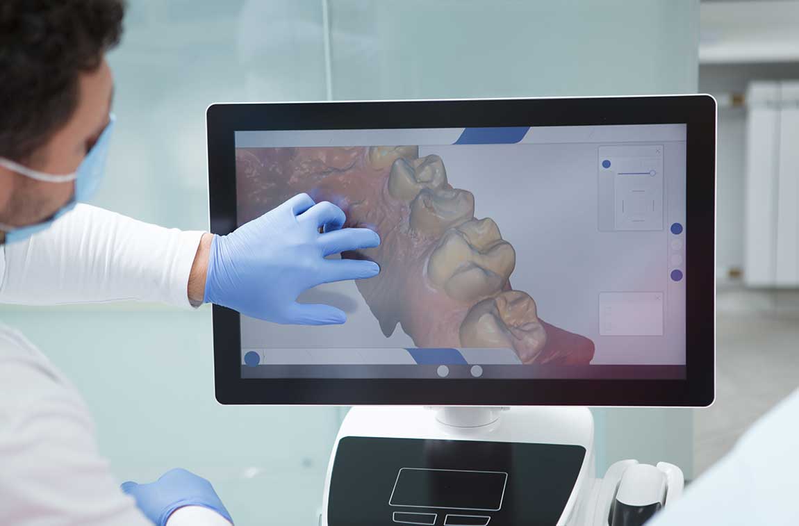 Computer-Guided Implant Surgery in Northern Virginia